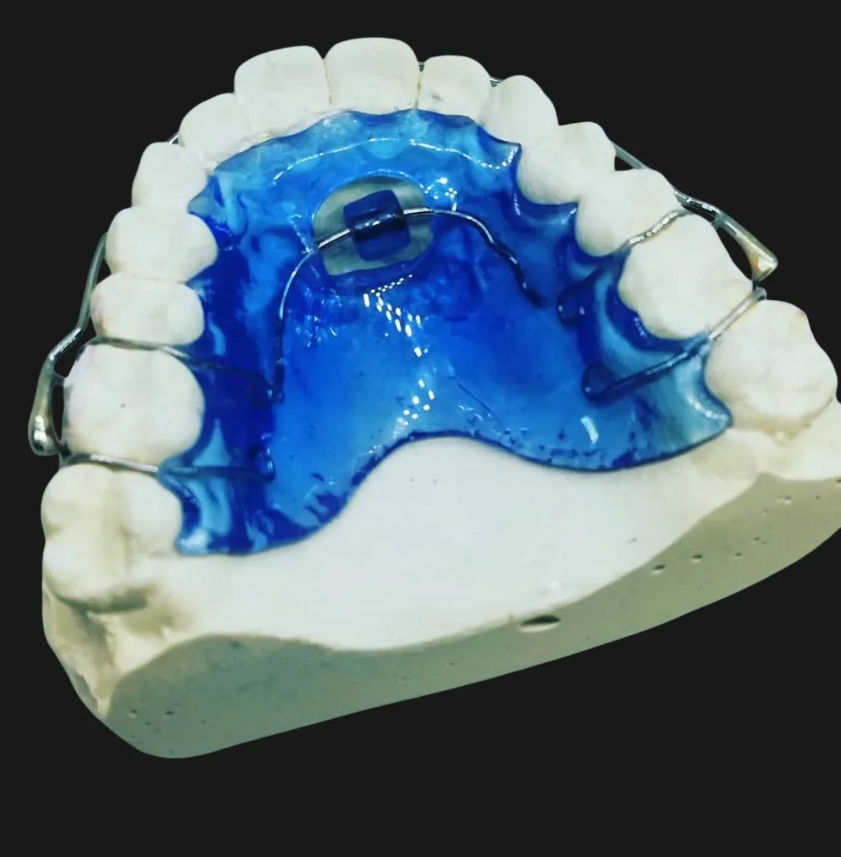 Orthodontic appliances and retainers